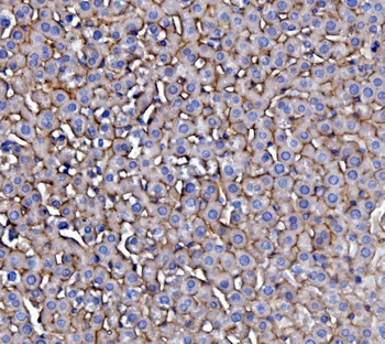 EGFR Rabbit Polyclonal Antibody