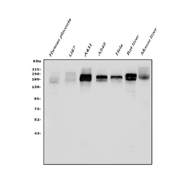 EGFR Rabbit Polyclonal Antibody