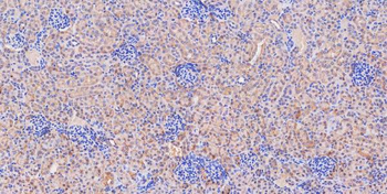 Glutaminase/GLS Rabbit Polyclonal Antibody