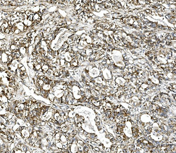 Glutaminase/GLS Rabbit Polyclonal Antibody