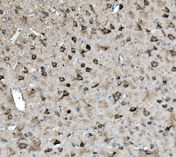 Glutaminase/GLS Rabbit Polyclonal Antibody