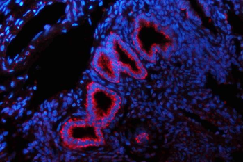 Glutaminase/GLS Rabbit Polyclonal Antibody