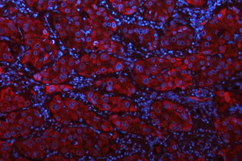 Glutaminase/GLS Rabbit Polyclonal Antibody