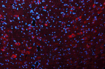 Glutaminase/GLS Rabbit Polyclonal Antibody