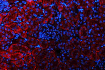 Glutaminase/GLS Rabbit Polyclonal Antibody