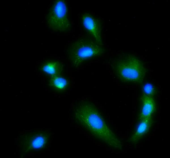 Glutaminase/GLS Rabbit Polyclonal Antibody