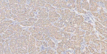 Glutaminase/GLS Rabbit Polyclonal Antibody