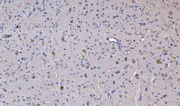 Glutaminase/GLS Rabbit Polyclonal Antibody