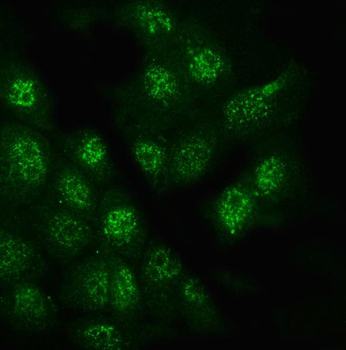 Glypican 5/GPC5 Rabbit Polyclonal Antibody