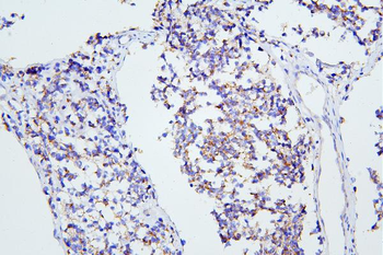 mGluR1/GRM1 Rabbit Polyclonal Antibody