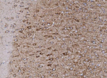 mGluR1/GRM1 Rabbit Polyclonal Antibody