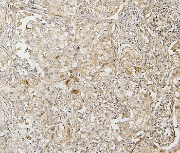 IRF3 Rabbit Polyclonal Antibody