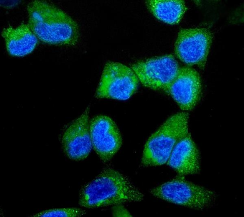 ITCH/AIP4 Rabbit Polyclonal Antibody