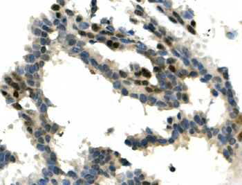 ITCH/AIP4 Rabbit Polyclonal Antibody