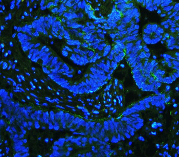Integrin beta 4/ITGB4 Rabbit Polyclonal Antibody