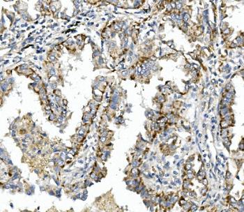 Integrin beta 4/ITGB4 Rabbit Polyclonal Antibody