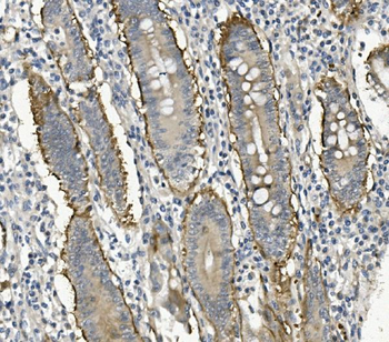 Integrin beta 4/ITGB4 Rabbit Polyclonal Antibody