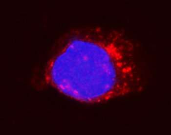 Integrin beta 5/ITGB5 Rabbit Polyclonal Antibody