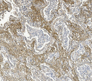 Integrin beta 5/ITGB5 Rabbit Polyclonal Antibody