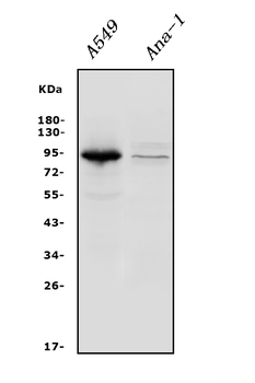 Integrin beta 5/ITGB5 Rabbit Polyclonal Antibody