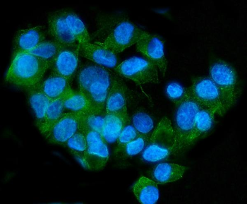 ApoER2/LRP8 Rabbit Polyclonal Antibody