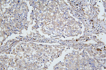 ApoER2/LRP8 Rabbit Polyclonal Antibody