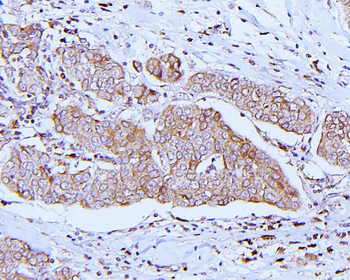 ApoER2/LRP8 Rabbit Polyclonal Antibody