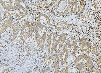 ApoER2/LRP8 Rabbit Polyclonal Antibody
