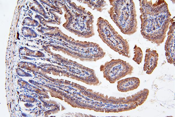 ApoER2/LRP8 Rabbit Polyclonal Antibody