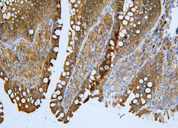ApoER2/LRP8 Rabbit Polyclonal Antibody