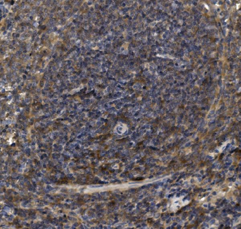 LY6C Rabbit Polyclonal Antibody
