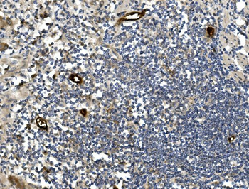 MAdCAM1 Rabbit Polyclonal Antibody