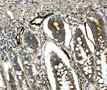 MAdCAM1 Rabbit Polyclonal Antibody