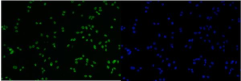 MCM6 Rabbit Polyclonal Antibody