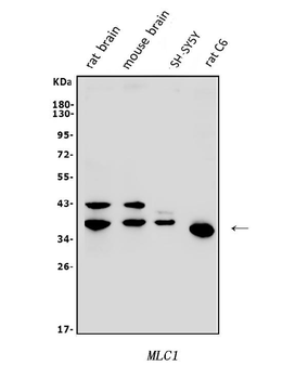 MLC1 Rabbit Polyclonal Antibody
