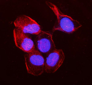 non-muscle Myosin IIB/MYH10 Rabbit Polyclonal Antibody