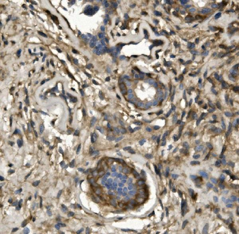 non-muscle Myosin IIB/MYH10 Rabbit Polyclonal Antibody