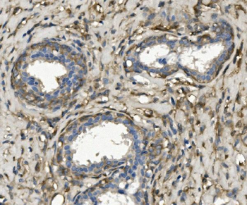 non-muscle Myosin IIB/MYH10 Rabbit Polyclonal Antibody