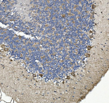 non-muscle Myosin IIB/MYH10 Rabbit Polyclonal Antibody