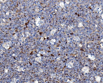 NOXA2/p67phox/NCF2 Rabbit Polyclonal Antibody