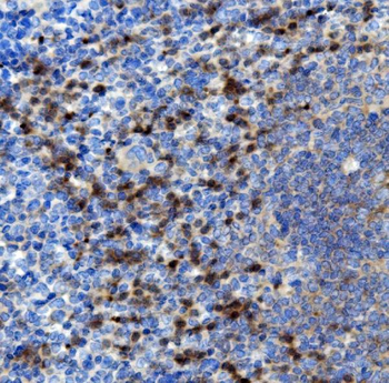 NOXA2/p67phox/NCF2 Rabbit Polyclonal Antibody