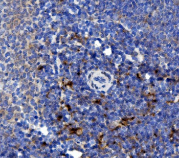 NOXA2/p67phox/NCF2 Rabbit Polyclonal Antibody