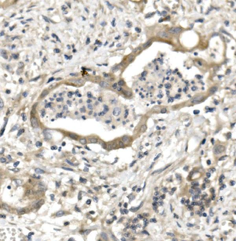 PVRL1/NECTIN1 Rabbit Polyclonal Antibody