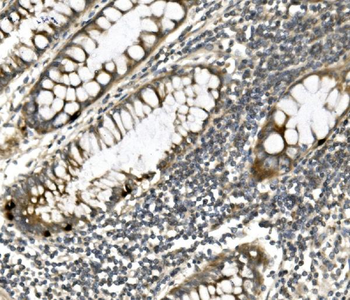 PVRL1/NECTIN1 Rabbit Polyclonal Antibody