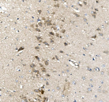 PVRL1/NECTIN1 Rabbit Polyclonal Antibody