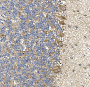 PVRL1/NECTIN1 Rabbit Polyclonal Antibody