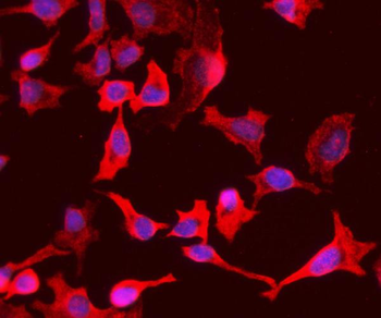 PCK1/PEPC Rabbit Polyclonal Antibody