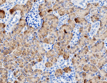 PCK1/PEPC Rabbit Polyclonal Antibody