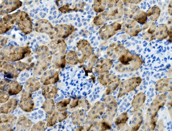 PCK1/PEPC Rabbit Polyclonal Antibody