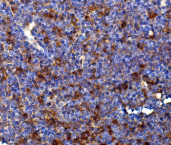 Rad17 Rabbit Polyclonal Antibody